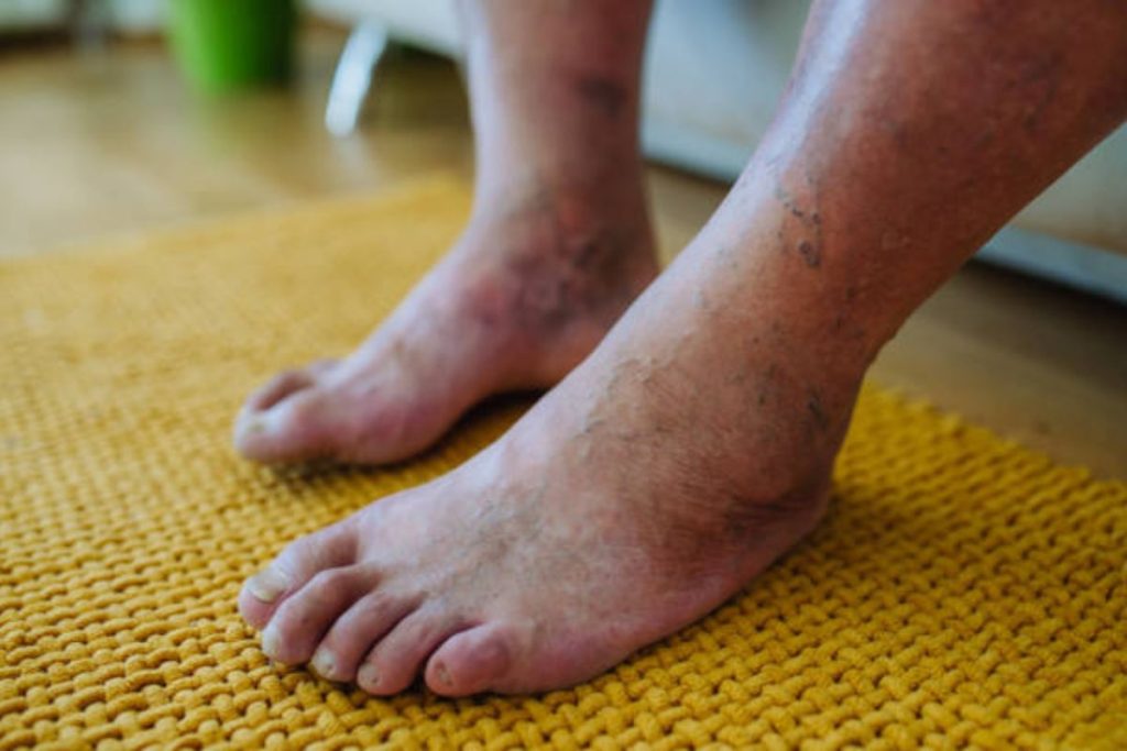 Diabetic Foot Care - The Barefoot Clinic