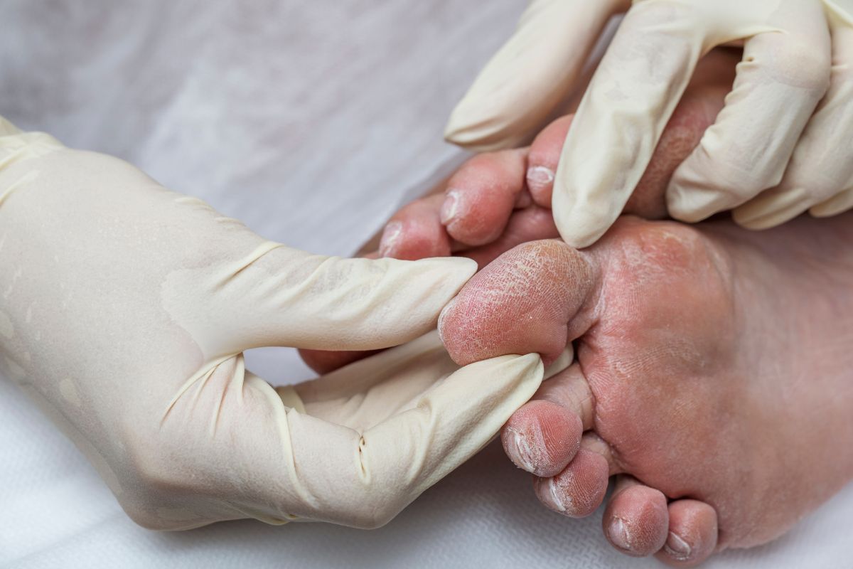 Diabetic Foot Care - The Barefoot Clinic